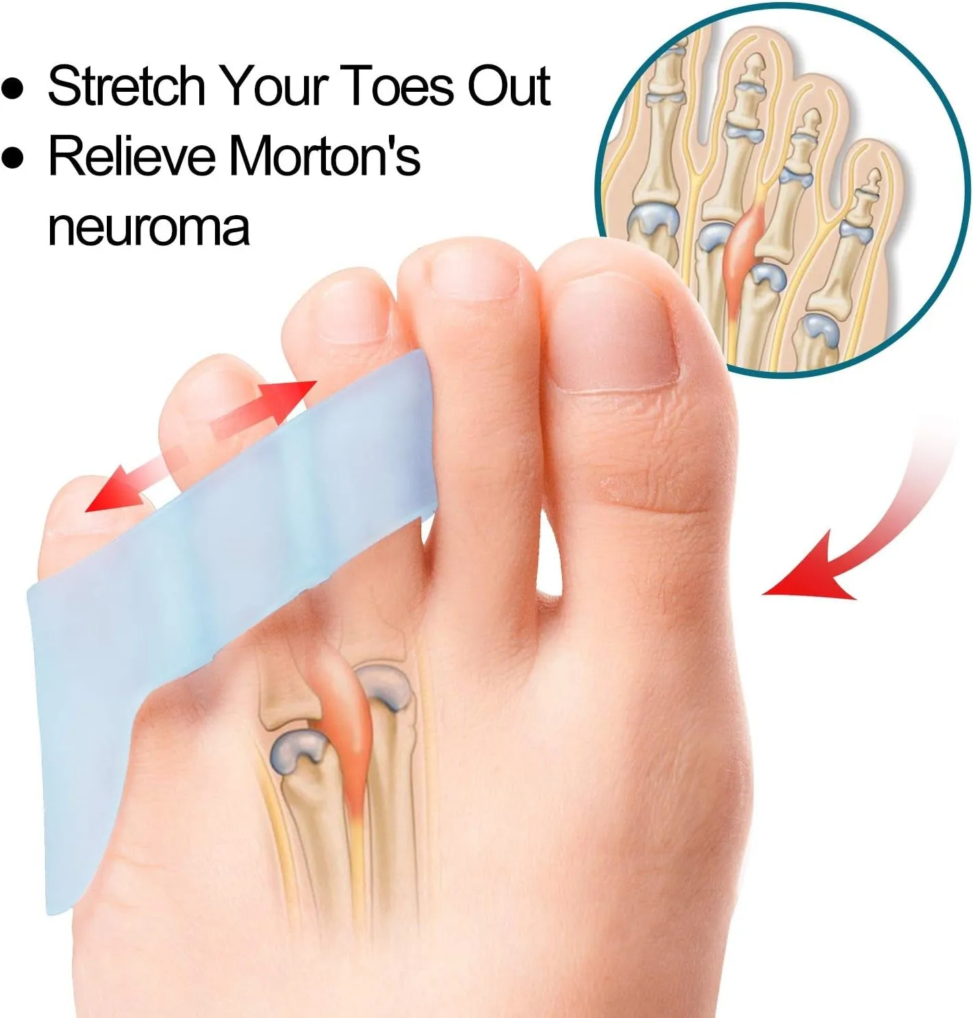 10 Pack Pinky Toe Separator and Protectors for Overlapping Toe, Curled Pinky Toes - Spacers for Morton'S Neuroma Pain Relief